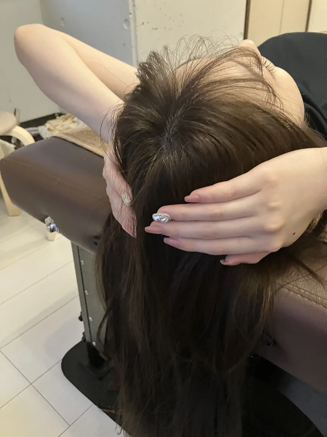 小顔矯正の施術前イメージ